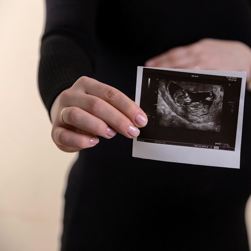 Échographie de grossesse tenue devant un ventre arrondi